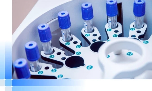 Global Batch Tracking in Life Sciences Manufacturing