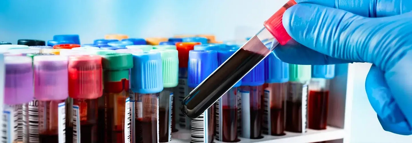 Revolutionizing finance and accounting operations for a global healthcare enterprise