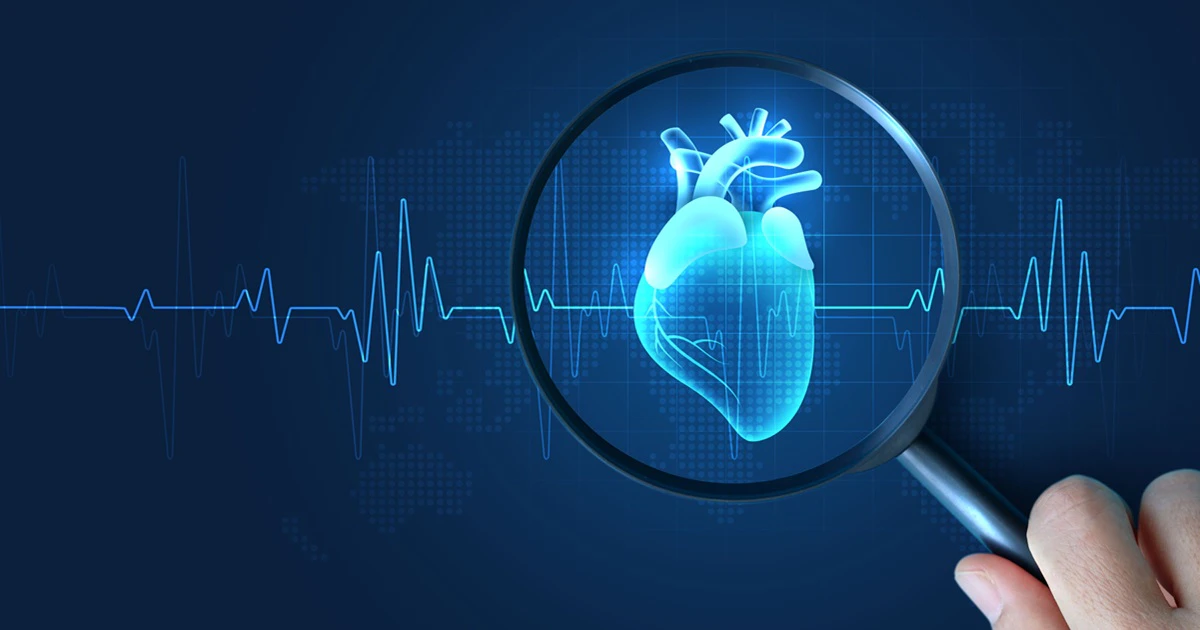Cardiac Protection Next-Gen Myocardial Protection in Cardiac Care | HCLTech