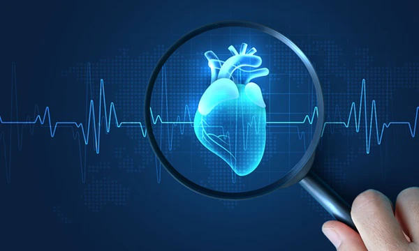 Advancing cardiac care with next-generation myocardial protection systems Advancing cardiac care with next-generation myocardial protection systems